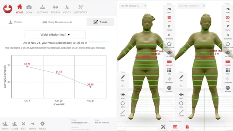 Styku vs. Evolt 360: A 3D Body Scanner Comparison